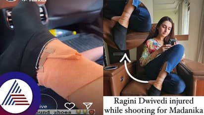 ಶೂಟಿಂಗ್ ವೇಳೆ ಭಾರಿ ಅವಘಡ: ತುಪ್ಪದ ಬೆಡಗಿ ರಾಗಿಣಿ ಕಾಲಿಗೆ ಏಟು- ಚಿತ್ರೀಕರಣ ಕ್ಯಾನ್ಸಲ್