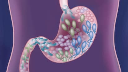കുടലിൽ നല്ല ബാക്ടീരിയകൾ വര്ധിക്കാന് കഴിക്കേണ്ട എട്ട് ഭക്ഷണങ്ങള്...