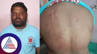 ಜಮೀನು ವಿವಾದ ಕಾಂಗ್ರೆಸ್ ಮುಖಂಡನ ಕಟ್ಟಿಹಾಕಿ ಮಾರಣಾಂತಿಕ ಹಲ್ಲೆ!  