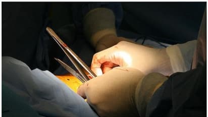 നിർണായക ശസ്ത്രക്രിയ, മനുഷ്യരാശിക്ക് നേട്ടമാകുമോ; ജനിതകമാറ്റം വരുത്തിയ പന്നിവൃക്ക മനുഷ്യനിൽ മാറ്റിവെച്ചു