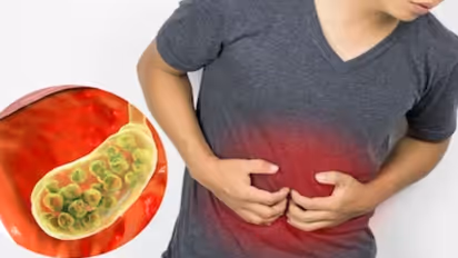 ಫ್ಯಾಟಿ ಲಿವರ್; ಪ್ರತಿ 3ರಲ್ಲಿ ಒಬ್ಬ ಭಾರತೀಯನಿಗೆ ಕಾಡುತ್ತೆ ಈ ಅಪಾಯಕಾರಿ ಕಾಯಿಲೆ, ಕಾರಣ, ಚಿಕಿತ್ಸೆ ವಿವರ ಇಲ್ಲಿದೆ..