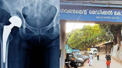 35കാരിക്ക് ഇടുപ്പിൽ വേദന, വയനാട് മെഡിക്കല് കോളേജിലെത്തി, പരിശോധനയിൽ ഗുരുതരമെന്ന് കണ്ടെത്തൽ; ശസ്ത്രക്രിയ വിജയം