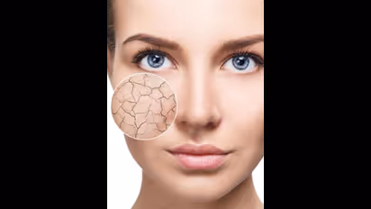 வறண்ட சருமம்? தயிரை இப்படி யூஸ் பண்ணுங்க முகம் பட்டு போல மென்மையாகும்!