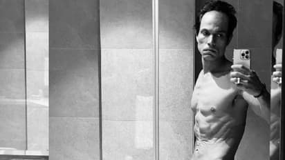 SHOCKING! एक्टर  Randeep Hooda का ये क्या हुआ हाल, धंसा पेट और बाल देख फैंस हो गए परेशान...