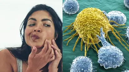 ശ്രദ്ധിക്കൂ, ഈ വൈറൽ ബ്യൂട്ടി ടിപ്പുകൾ സ്കിന് ക്യാന്സറിന് കാരണമാകും...