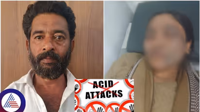 Bengaluru shocker: Husband throws acid on wife allegedly over marital dispute; check details