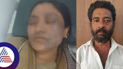 ಅಡುಗೆ ಮಾಡಲು ಸಾಮಾನು ತರುವಂತೆ ಹೇಳಿದ್ದಕ್ಕೇ ಪತ್ನಿಯ ಮೇಲೆ ಆಸಿಡ್ ಎರಚಿ ಪರಾರಿಯಾದ ಕಿರಾತಕ ಗಂಡ!