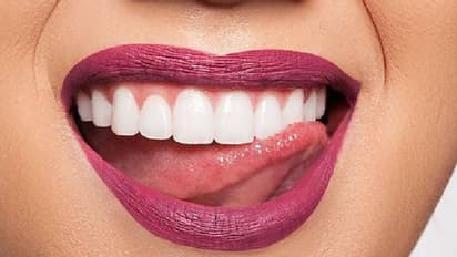 Oral health day2024 :दांतों को हिलाकर रख देती हैं छोटी-छोटी गलतियां, इन आदतों से नहीं होगी कैविटी की समस्या