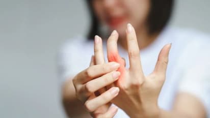 റൂമറ്റോയ്ഡ് ആർത്രൈറ്റിസ് ഒഴിവാക്കാൻ ഡയറ്റില് ഉള്പ്പെടുത്താം ഈ ഭക്ഷണങ്ങള്...