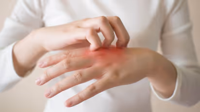 Health Tips: എക്സീമയുടെ ഈ ലക്ഷണങ്ങളെ അറിയാതെ പോകരുത്...