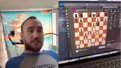 Neuralink: ಮೆದುಳಿಗೆ ಚಿಪ್ ಹಾಕಿದ ಬಳಿಕ ತಲೇಲಿ ಯೋಚಿಸಿ ಕಂಪ್ಯೂಟರಲ್ಲಿ ಚೆಸ್ ಆಡಿದ!