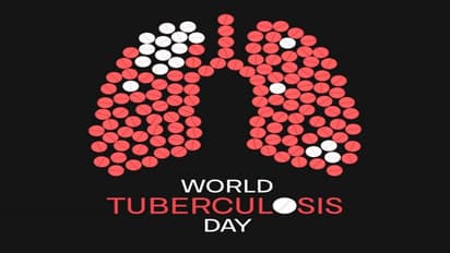 World Tuberculosis Day 2024: what is the significance of the day?