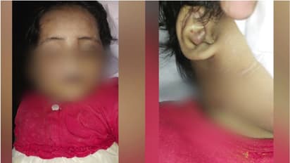 Malappuram child death: Phone conversation between relative, neighbour reveals brutality of murder