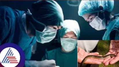 ಗುದದ ಮೂಲಕ ಹೊಟ್ಟೆಗ್ಹೋದ ಹಾವು, ಜೀವಂತವಾಗಿ ಹೊರ ತೆಗೆದ ಡಾಕ್ಟರ್ಸ್ !