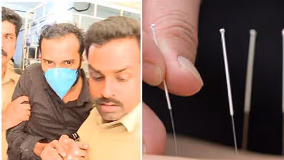 അറിവില്ലാത്തവർ ചെയ്താൽ ദുരന്തം, ഇനി അത് സംഭവിച്ചുകൂടാ; അക്യൂപങ്ക്ചർ നടത്തുന്ന വ്യാജൻമാരെ തടയണമെന്ന് ഇനിഗ്മ