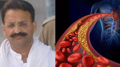 मुख्तार अंसारी की मौत का कारण था कार्डियक अरेस्ट, हार्ट अटैक और कार्डियक अटैक होती हैं अलग कंडीशन