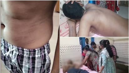 'ഭിന്നശേഷിക്കാരനായ 16കാരന് ക്രൂര മര്ദനം'; പ്രിന്സിപ്പളിനെതിരെയും ജീവനക്കാരിക്കെതിരെയും കേസെടുത്ത് പൊലീസ്