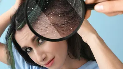 5 Essential tips to prevent hair dandruff and care for your hair this winter