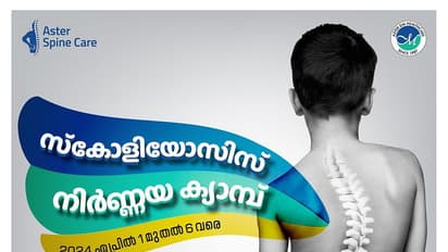 സ്കോളിയോസിസിന് ആസ്റ്റർ മെഡ്‌സിറ്റിയിൽ പരിശോധനാക്യാമ്പ്; ചികിത്സാചെലവിൽ വൻ ഇളവുകൾ