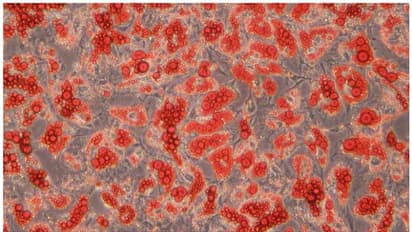 എന്താണ് ബ്രൗൺ ഫാറ്റ് ?  ആരോഗ്യകരമാണോ? അറിയേണ്ടതെല്ലാം