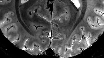 World's most powerful MRI scanner unveils groundbreaking insights into human brain function (WATCH)