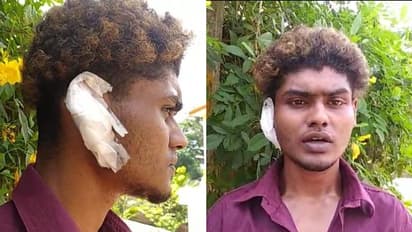 'തുറിച്ച് നോക്കി'; കൂട്ടുകാരനെ കാണാൻ പോയ യുവാവിനെ മർദ്ദിച്ച് ചെവി കടിച്ച് പറിച്ചു, ബൈക്ക് നശിപ്പിച്ചു