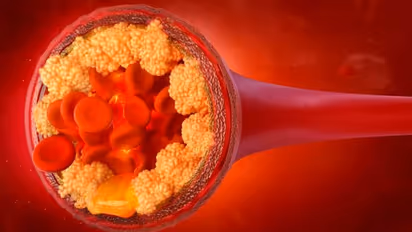 കൊളസ്‌ട്രോള്‍ കുറയ്ക്കണോ? ഡയറ്റില്‍ ഉള്‍പ്പെടുത്താം ഈ സുഗന്ധവ്യജ്ഞനങ്ങൾ...