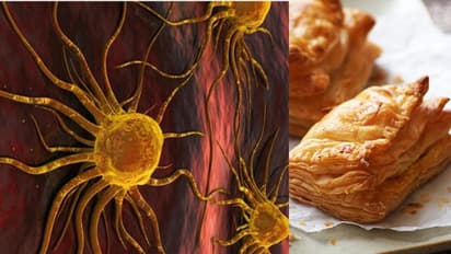 ബേക്കറിയില്‍ നിന്നും വാങ്ങുന്ന ഈ ഭക്ഷണങ്ങള്‍ ക്യാൻസറിന് കാരണമാകും... 