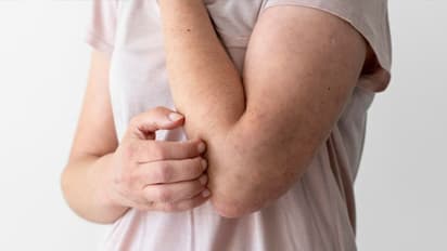 ശരീരത്തില് ഇത്തരം ലക്ഷണങ്ങള് പ്രകടമാകുന്നുണ്ടോ? എങ്കില്, നിങ്ങളുടെ കരള് അപകടത്തിലാണ്...