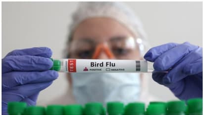 കാനഡയില്‍ കൗമാരക്കാരനിൽ എച്ച്5എൻ1 പക്ഷിപ്പനി വൈറസ്ബാധ സ്ഥിരീകരിച്ചു 