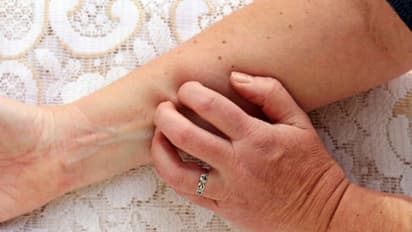 ഇതിലേതെങ്കിലും ലക്ഷണങ്ങൾ നിങ്ങൾക്കുണ്ടോ? അവഗണിക്കരുത്, ശരീരത്തിലെ ഈ മാറ്റങ്ങള്‍ വൃക്കരോഗത്തിന്‍റെയാകാം...