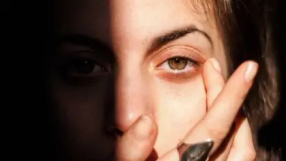 आंखों को दिखता है धुंधला, ब्लैक स्पॉट आते हैं नज़र, इतना खतनाक हो सकता है सूर्यग्रहण को देखना