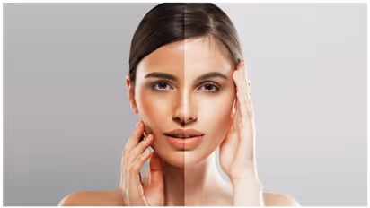 வெயில்ல முகம் கருப்பாயிடுச்சா? இரவில் '1' ஸ்பூன் தயிர்ல இந்த பேஸ் பேக் போடுங்க!!