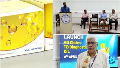 97.71 % കൃത്യത, അതിവേഗത്തിൽ ക്ഷയരോഗം തിരിച്ചറിയാം, നേട്ടവുമായി ശ്രീ ചിത്തിര തിരുന്നാള് ഇൻസ്റ്റിറ്റ്യൂട്ട്