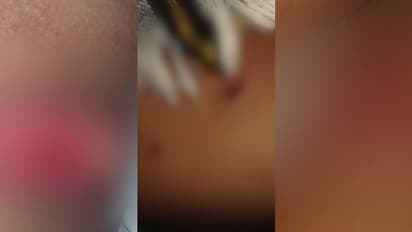 7വയസുകാരനെ തെരുവുനായ്ക്കൾ കൂട്ടം ചേര്ന്ന് ആക്രമിച്ചു, ഗുരുതര പരിക്ക്; ദാരുണ സംഭവം പാലക്കാട്