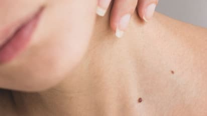 ക്യാന്സര്; ശരീരം മുൻകൂട്ടി കാണിക്കുന്ന പൊതുവായ പത്ത് ലക്ഷണങ്ങൾ...