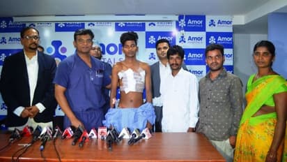 హైదరాబాద్ డాక్టర్లు అదుర్స్ ... యువకుడి చెస్ట్ ను పూర్తిగా మార్చిపడేసారుగా..!