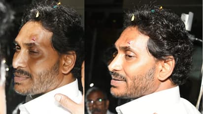 ಚುನಾವಣಾ ಪ್ರಚಾರದ ವೇಳೆ ಕಲ್ಲು ತೂರಾಟ, ಸಿಎಂ ಜಗನ್ ಮೋಹನ್ ರೆಡ್ಡಿಗೆ ಗಾಯ!