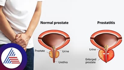 ಮೂತ್ರ ವಿಸರ್ಜಿಸಿದ ನಂತರವೂ ರಿಲ್ಯಾಕ್ಸ್ ಫೀಲ್ ಆಗ್ತಿಲ್ವಾ? ಏನಿರಬಹುದು ರೀಸನ್?