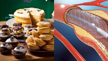 ബേക്കറി പലഹാരങ്ങള്ക്ക് പകരം ഇവ കഴിക്കൂ, ചീത്ത കൊളസ്ട്രോള് കുറയ്ക്കാം...