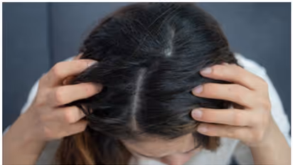 ദിവസം കഴിയുന്തോറും മുടിയുടെ കട്ടി കുറയുന്നുണ്ടോ? എങ്കിൽ ശ്രദ്ധിക്കേണ്ടത്...