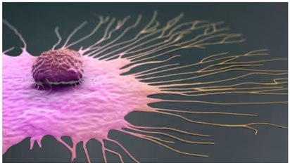 സ്തനാര്ബുദം ; ശരീരം കാണിക്കുന്ന അഞ്ച് ലക്ഷണങ്ങൾ