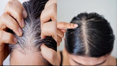 अब छोड़े डाई-वाई का चक्कर,सफेद बालों को इस पीली चीज से करें काला,नहीं होंगे Side Effects