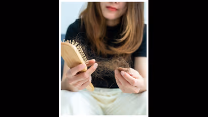 కొబ్బరి నూనెలో ఇదొక్కటి కలిపి పెడితే మీ జుట్టు పెరగడం పక్కా..