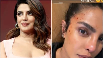 മുഖത്ത് രക്തവുമായി പ്രിയങ്ക ചോപ്ര; ചിത്രം പങ്കിട്ട് താരം