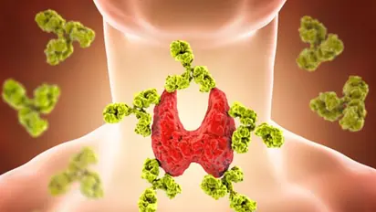 തൈറോയ്ഡ് ഗ്രന്ഥിയുടെ ആരോഗ്യത്തിന് ഹാനികരമാകുന്ന എട്ട് ഭക്ഷണങ്ങൾ... 