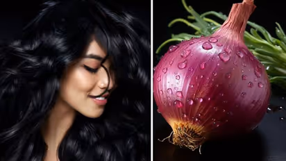 Magical benefits of onion juice can help you achieve fabulous hair