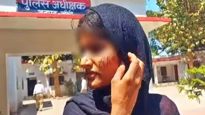 Lakhimpur Kheri horror: 17-year-old girl raped for 3 days, accused writes name on her face with hot iron rod