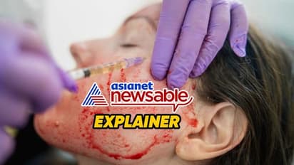 'Vampire facials' lead to women contracting HIV in New Mexico: Decoding PRP therapy, its risks & precautions