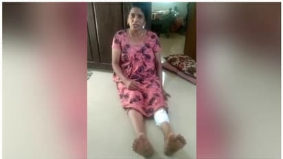 പാലക്കാട് പന്നിയുടെ കുത്തേറ്റ് വീട്ടമ്മയുടെ കാലിന് പരിക്കേറ്റു